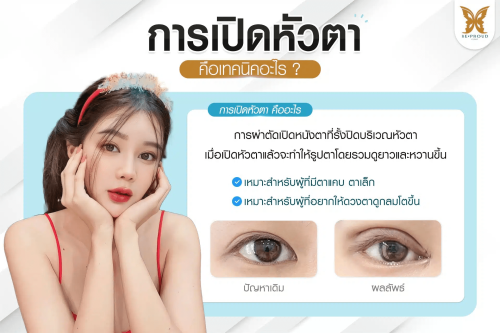 เปิดหัวตา, เปิดหัวตาคือ, เปิดหัวตาดีไหม, เปิดหัวตาเหมาะกับใคร, ข้อดีข้อเสียเปิดหัวตา, รีวิวเปิดหัวตา เปิดหัวตา, เปิดหัวตาคือ, เปิดหัวตาดีไหม, เปิดหัวตาเหมาะกับใคร, ข้อดีข้อเสียเปิดหัวตา, รีวิวเปิดหัวตา