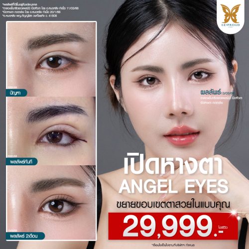 เปิดหางตา โปรรีวิว 29,999.- อีฟเปิดหางตา 11_3_66