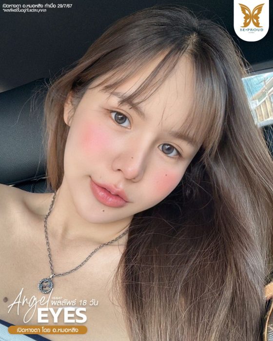 เปิดหางตา หมอหลิง