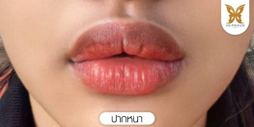 ปากหนา ปากหนา