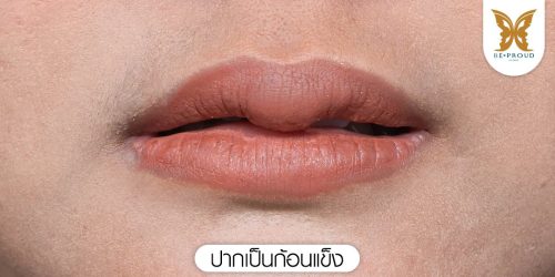 ปากเป็นก้อนแข็ง ปากเป็นก้อนแข็ง