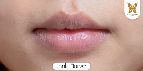 ปากไม่เป็นทรง ปากไม่เป็นทรง
