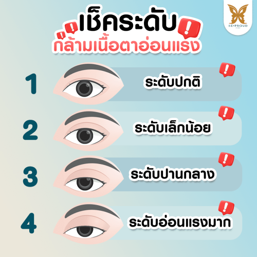กล้ามเนื้อตาอ่อนแรง กล้ามเนื้อตาอ่อนแรง